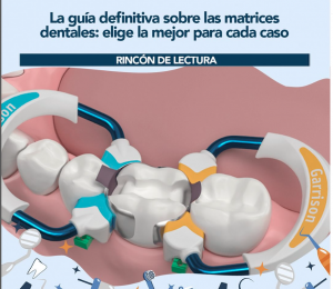 La guía definitiva sobre las matrices dentales