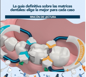 La guía definitiva sobre las matrices dentales: elige la mejor para cada caso